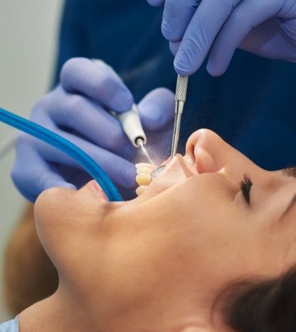 Woman getting a teeth cleaning