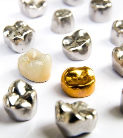 Several dental crowns of different colors and materials