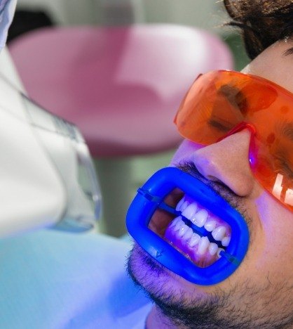 Man getting professional teeth whitening in dental office